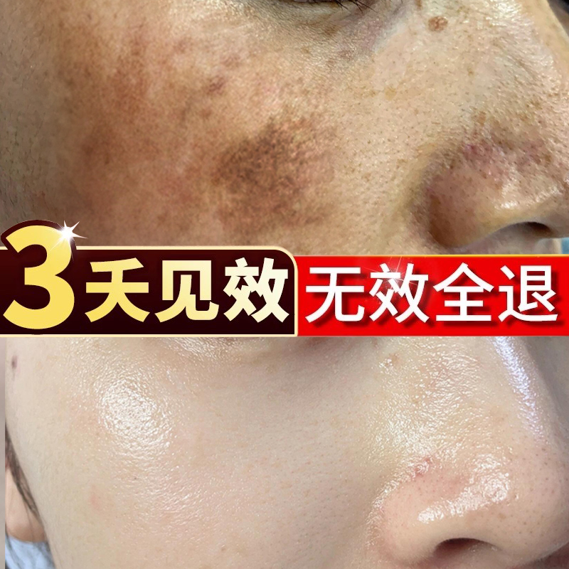 白芷的功效对皮肤好不好?原来美白祛斑有奇效!